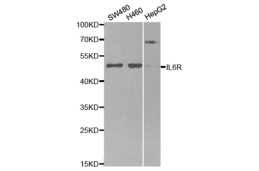 Western blot - IL6R Antibody from Signalway Antibody (32315) - Antibodies.com