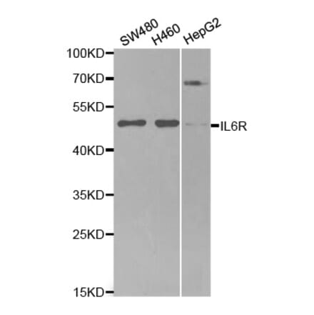 Western blot - IL6R Antibody from Signalway Antibody (32315) - Antibodies.com