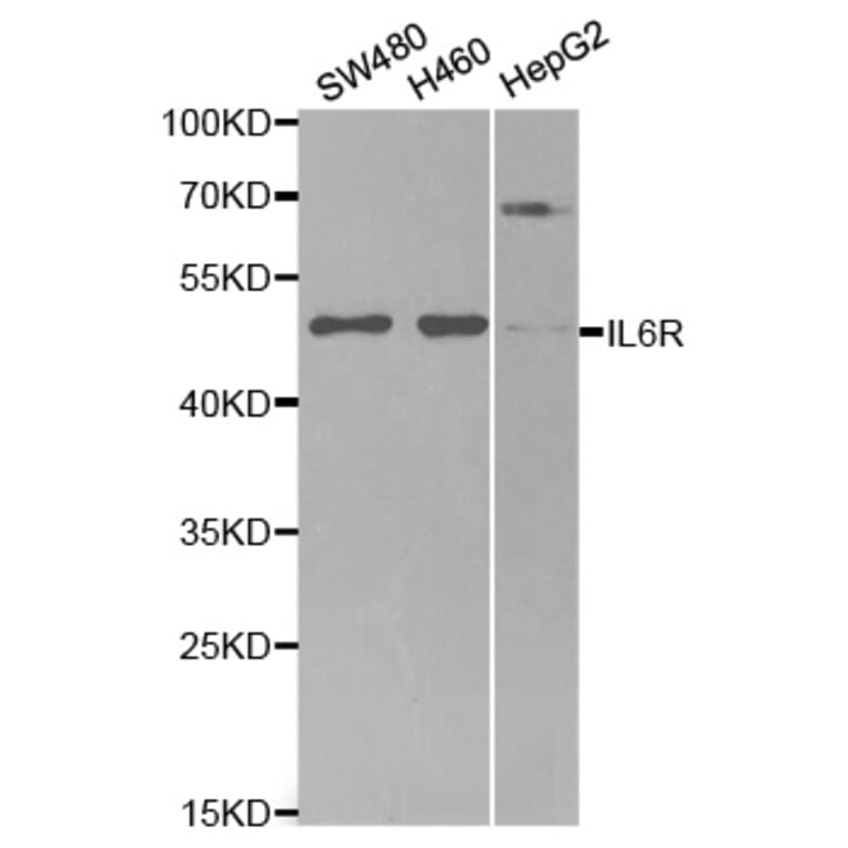 Western blot - IL6R Antibody from Signalway Antibody (32315) - Antibodies.com