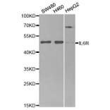 Western blot - IL6R Antibody from Signalway Antibody (32315) - Antibodies.com