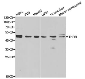 Western blot - THRB Antibody from Signalway Antibody (32325) - Antibodies.com