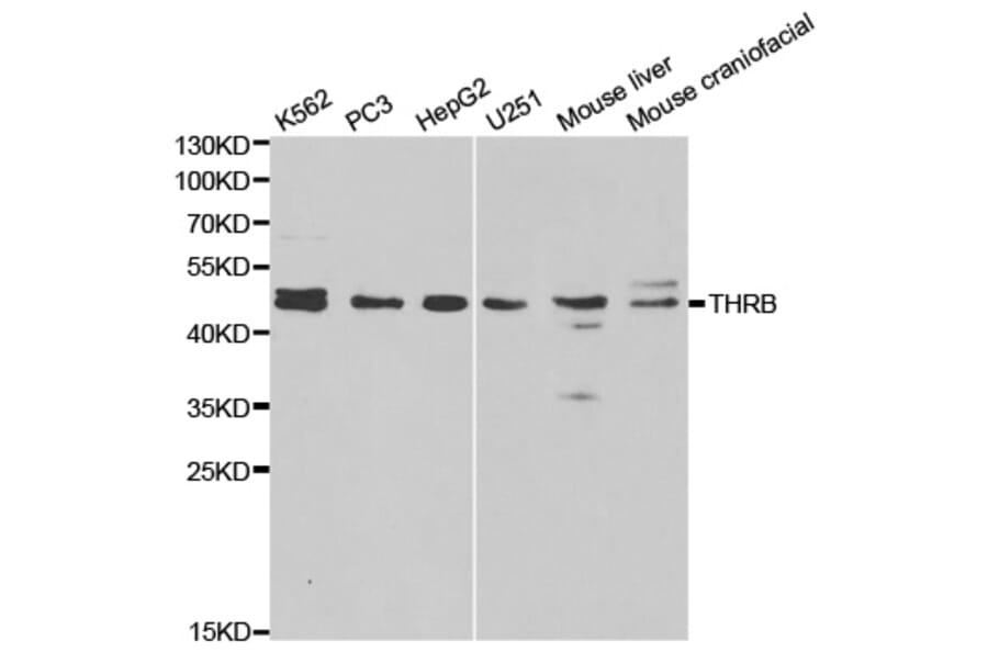 Western blot - THRB Antibody from Signalway Antibody (32325) - Antibodies.com