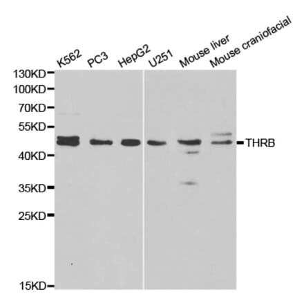 Western blot - THRB Antibody from Signalway Antibody (32325) - Antibodies.com