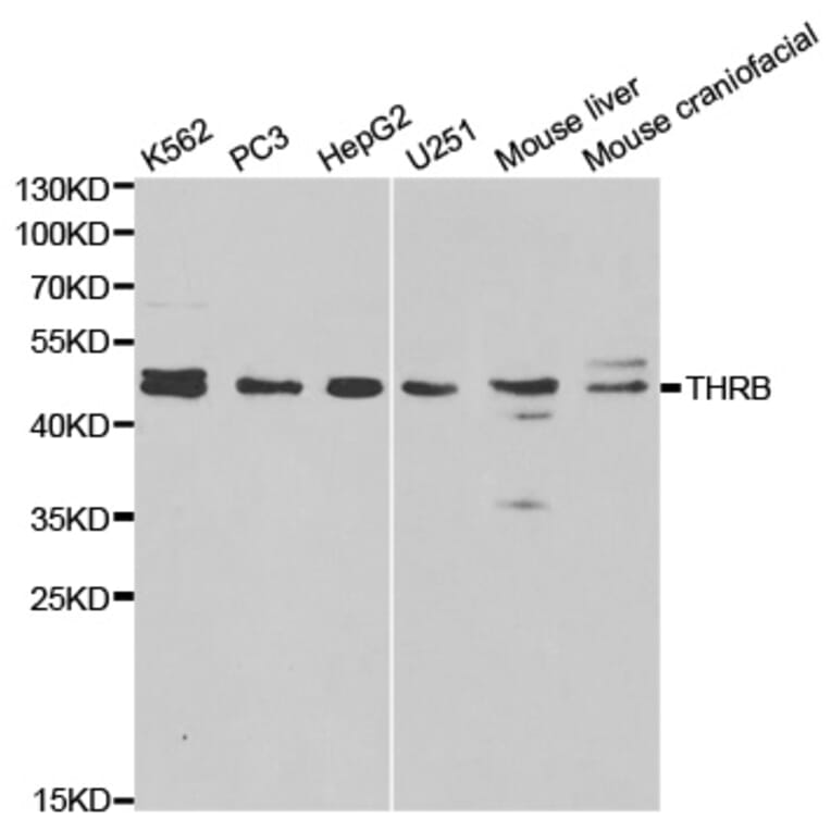 Western blot - THRB Antibody from Signalway Antibody (32325) - Antibodies.com