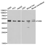Western blot - THRB Antibody from Signalway Antibody (32325) - Antibodies.com