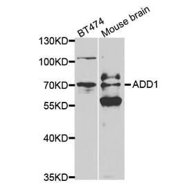 Western blot - ADD1 Antibody from Signalway Antibody (32329) - Antibodies.com