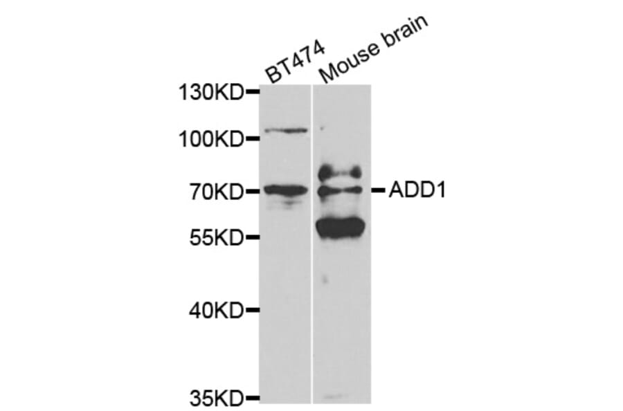 Western blot - ADD1 Antibody from Signalway Antibody (32329) - Antibodies.com