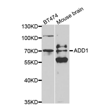 Western blot - ADD1 Antibody from Signalway Antibody (32329) - Antibodies.com