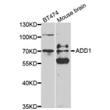 Western blot - ADD1 Antibody from Signalway Antibody (32329) - Antibodies.com