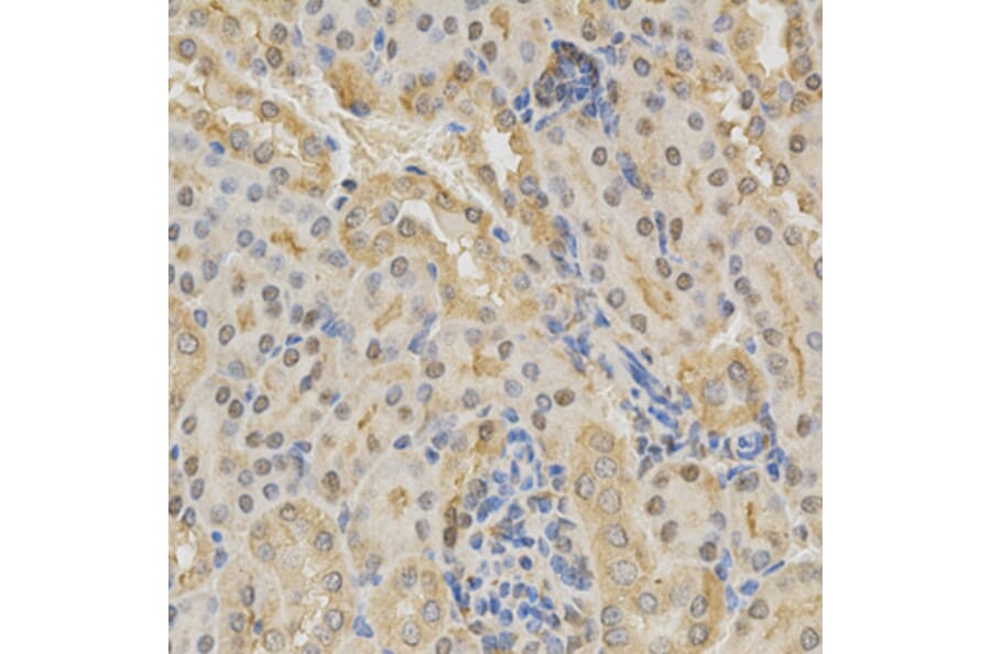 Immunohistochemistry - ADD1 Antibody from Signalway Antibody (32329) - Antibodies.com