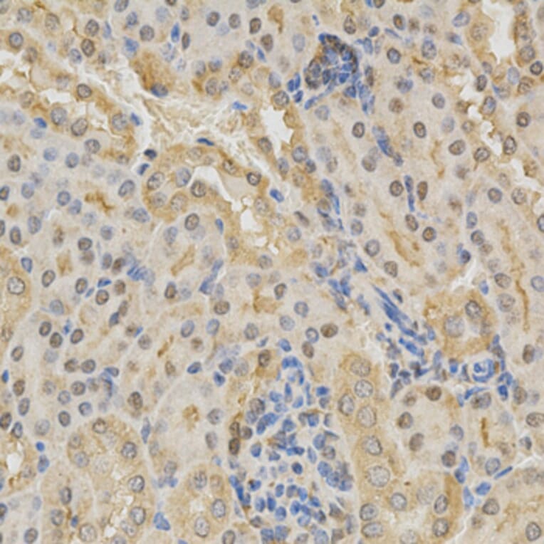 Immunohistochemistry - ADD1 Antibody from Signalway Antibody (32329) - Antibodies.com