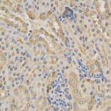 Immunohistochemistry - ADD1 Antibody from Signalway Antibody (32329) - Antibodies.com