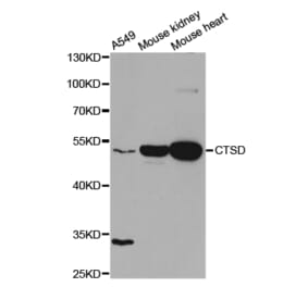 Western blot - CTSD Antibody from Signalway Antibody (32331) - Antibodies.com