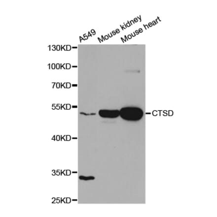 Western blot - CTSD Antibody from Signalway Antibody (32331) - Antibodies.com