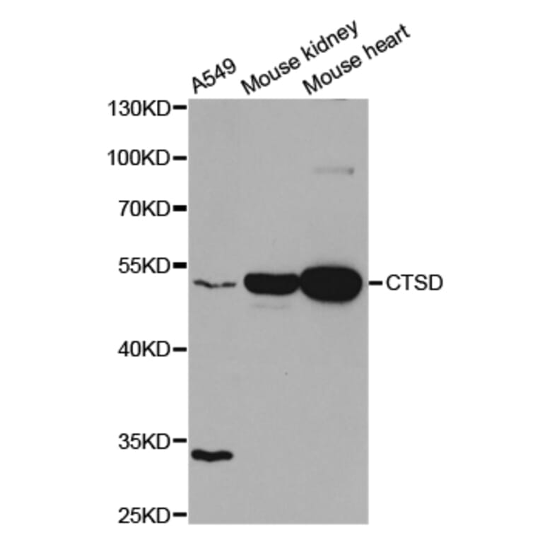 Western blot - CTSD Antibody from Signalway Antibody (32331) - Antibodies.com