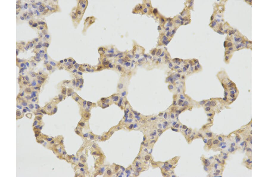 Immunohistochemistry - CTSD Antibody from Signalway Antibody (32331) - Antibodies.com