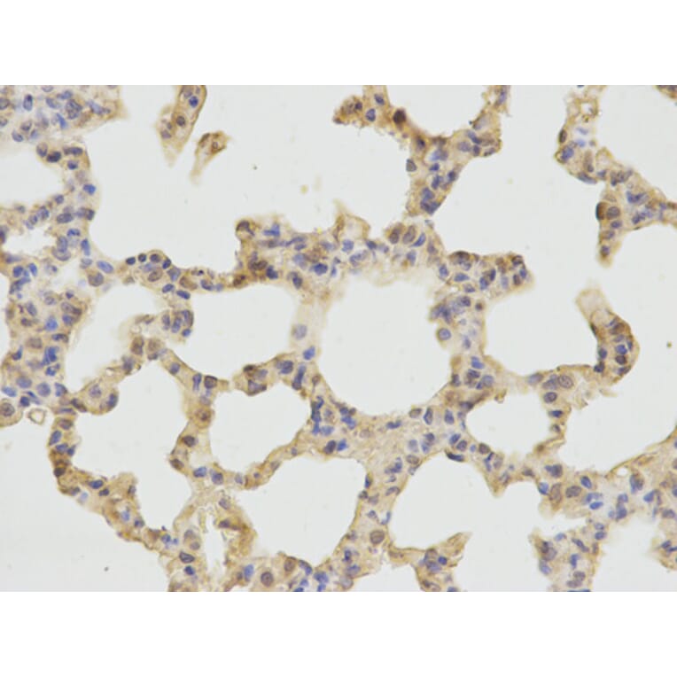 Immunohistochemistry - CTSD Antibody from Signalway Antibody (32331) - Antibodies.com