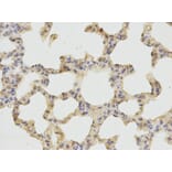 Immunohistochemistry - CTSD Antibody from Signalway Antibody (32331) - Antibodies.com