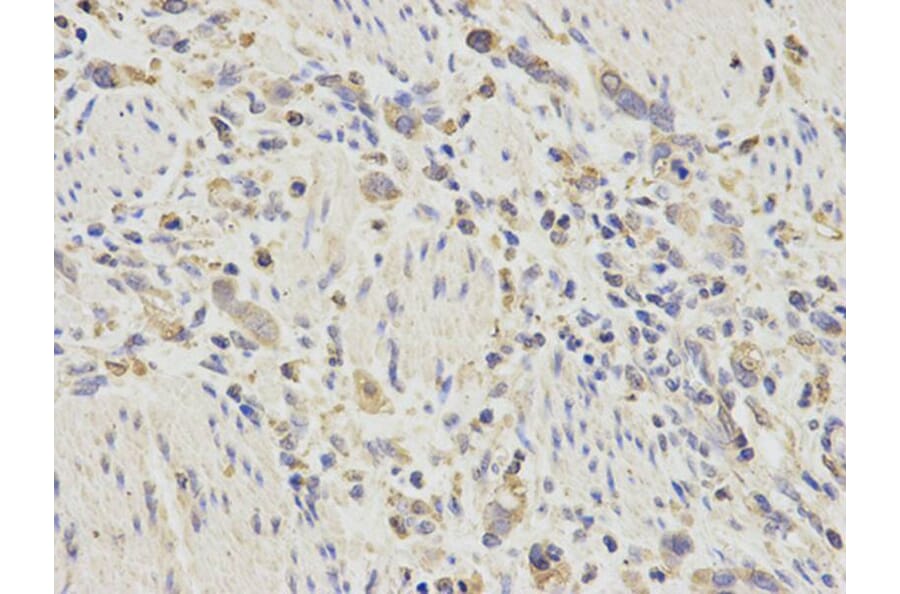 Immunohistochemistry - CTSD Antibody from Signalway Antibody (32331) - Antibodies.com