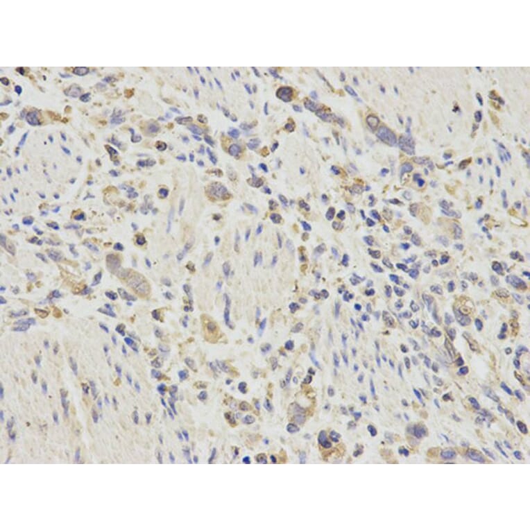 Immunohistochemistry - CTSD Antibody from Signalway Antibody (32331) - Antibodies.com