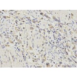 Immunohistochemistry - CTSD Antibody from Signalway Antibody (32331) - Antibodies.com