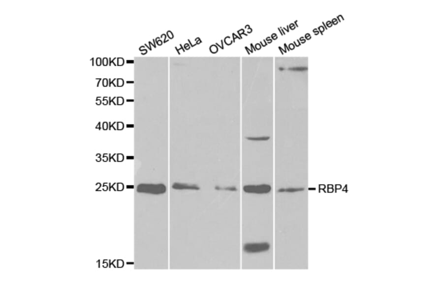 Western blot - RBP4 Antibody from Signalway Antibody (32334) - Antibodies.com