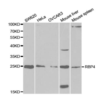 Western blot - RBP4 Antibody from Signalway Antibody (32334) - Antibodies.com