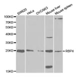 Western blot - RBP4 Antibody from Signalway Antibody (32334) - Antibodies.com
