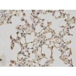 Immunohistochemistry - RBP4 Antibody from Signalway Antibody (32334) - Antibodies.com