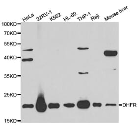 Western blot - DHFR Antibody from Signalway Antibody (32336) - Antibodies.com