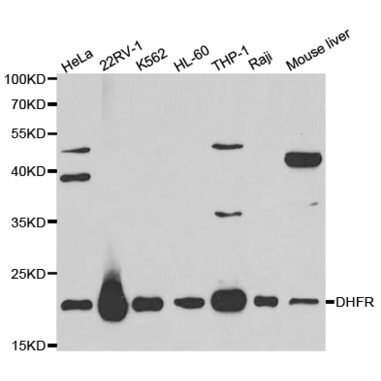 Western blot - DHFR Antibody from Signalway Antibody (32336) - Antibodies.com