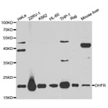 Western blot - DHFR Antibody from Signalway Antibody (32336) - Antibodies.com