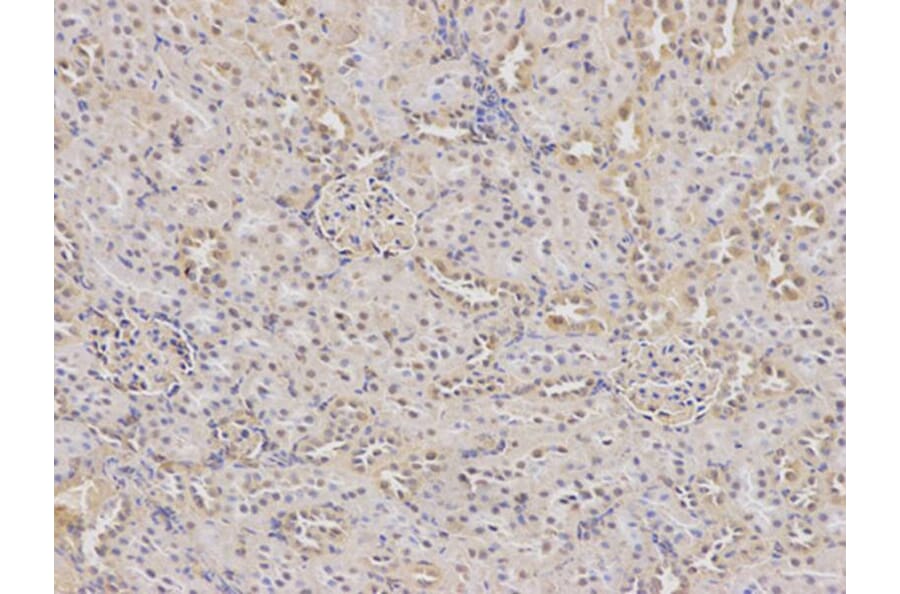Immunohistochemistry - DHFR Antibody from Signalway Antibody (32336) - Antibodies.com