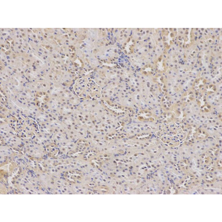 Immunohistochemistry - DHFR Antibody from Signalway Antibody (32336) - Antibodies.com