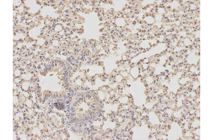 Immunohistochemistry - DHFR Antibody from Signalway Antibody (32336) - Antibodies.com