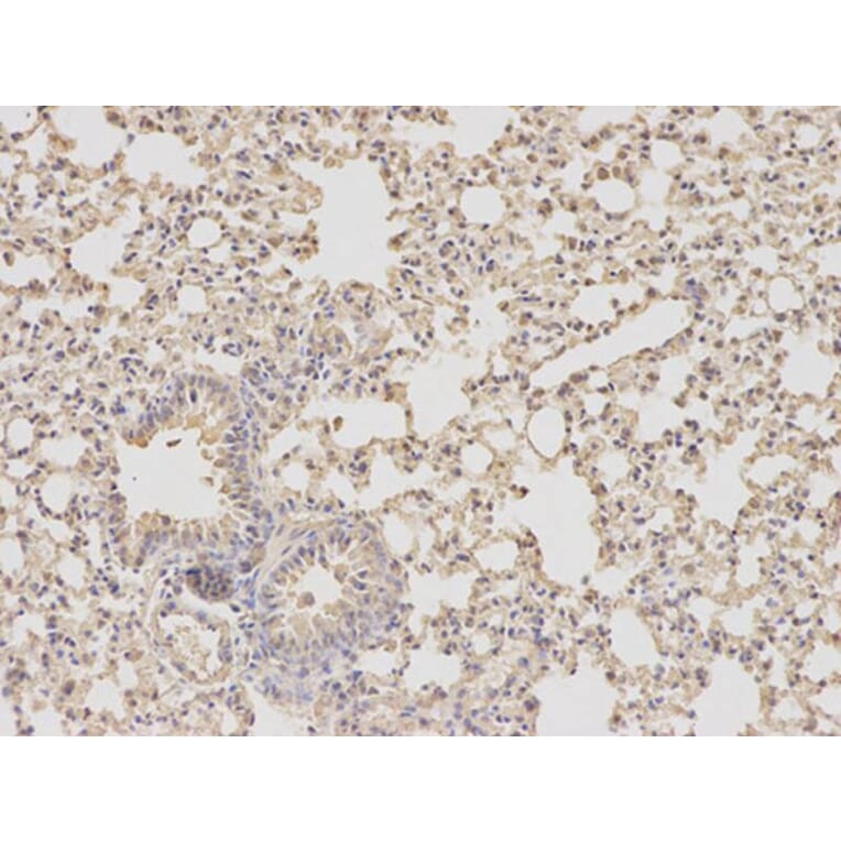 Immunohistochemistry - DHFR Antibody from Signalway Antibody (32336) - Antibodies.com