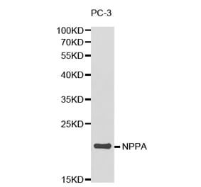 Western blot - NPPA Antibody from Signalway Antibody (32338) - Antibodies.com