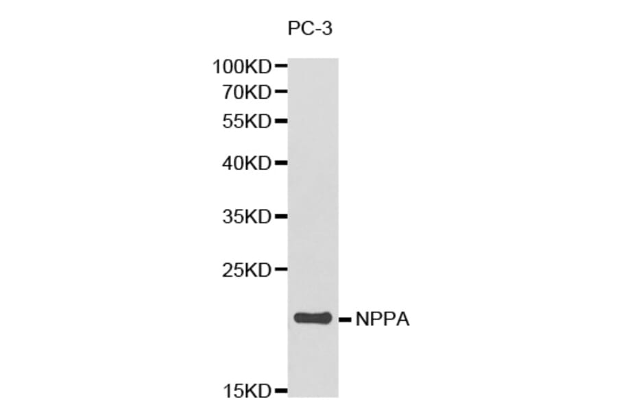 Western blot - NPPA Antibody from Signalway Antibody (32338) - Antibodies.com