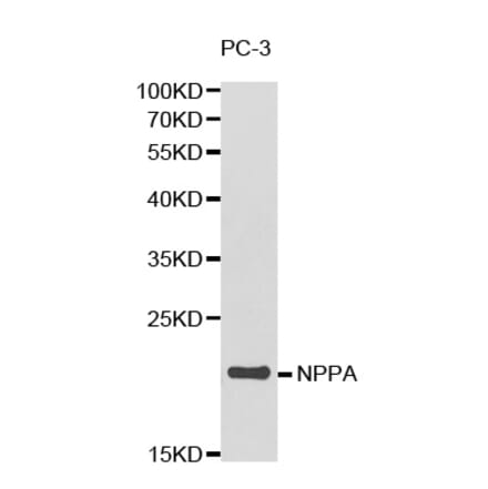 Western blot - NPPA Antibody from Signalway Antibody (32338) - Antibodies.com