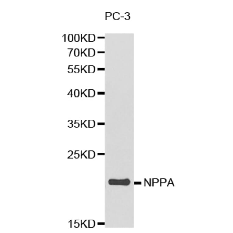 Western blot - NPPA Antibody from Signalway Antibody (32338) - Antibodies.com