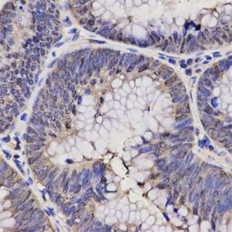 Immunohistochemistry - NPPA Antibody from Signalway Antibody (32338) - Antibodies.com