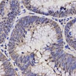 Immunohistochemistry - NPPA Antibody from Signalway Antibody (32338) - Antibodies.com