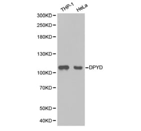 Western blot - DPYD Antibody from Signalway Antibody (32346) - Antibodies.com