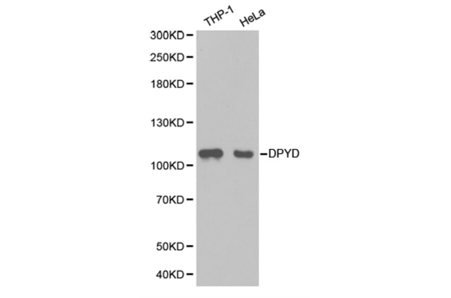 Western blot - DPYD Antibody from Signalway Antibody (32346) - Antibodies.com