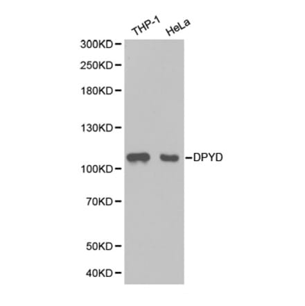 Western blot - DPYD Antibody from Signalway Antibody (32346) - Antibodies.com