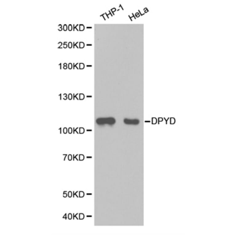 Western blot - DPYD Antibody from Signalway Antibody (32346) - Antibodies.com