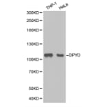 Western blot - DPYD Antibody from Signalway Antibody (32346) - Antibodies.com