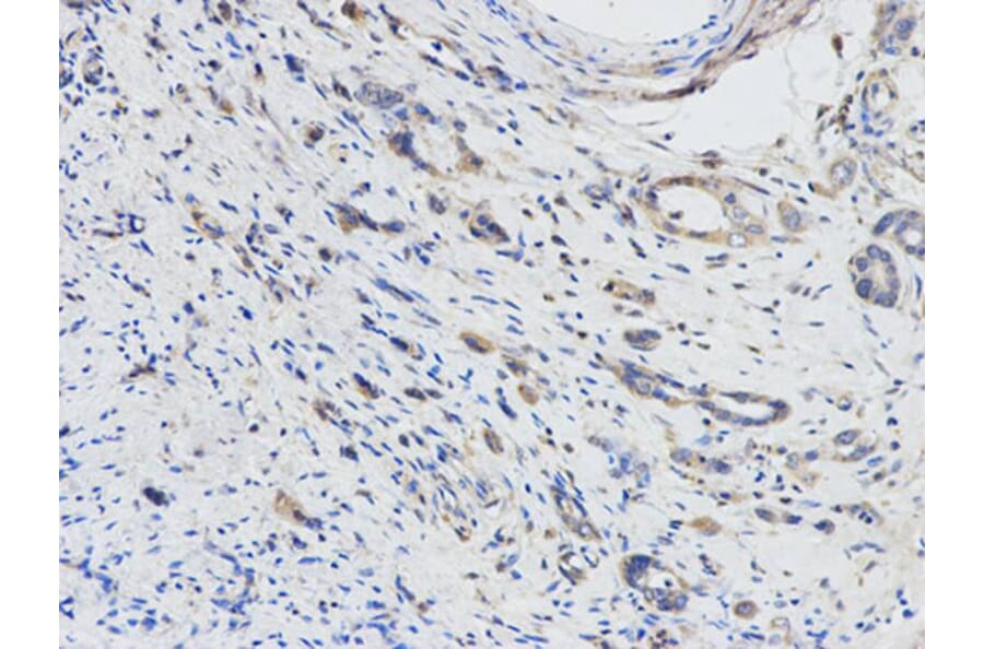 Immunohistochemistry - DPYD Antibody from Signalway Antibody (32346) - Antibodies.com