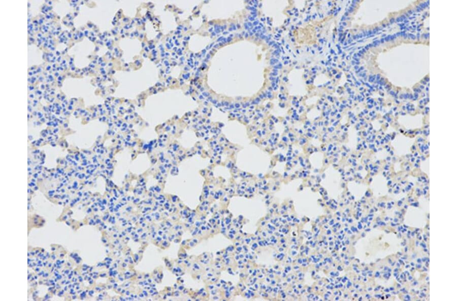 Immunohistochemistry - DPYD Antibody from Signalway Antibody (32346) - Antibodies.com