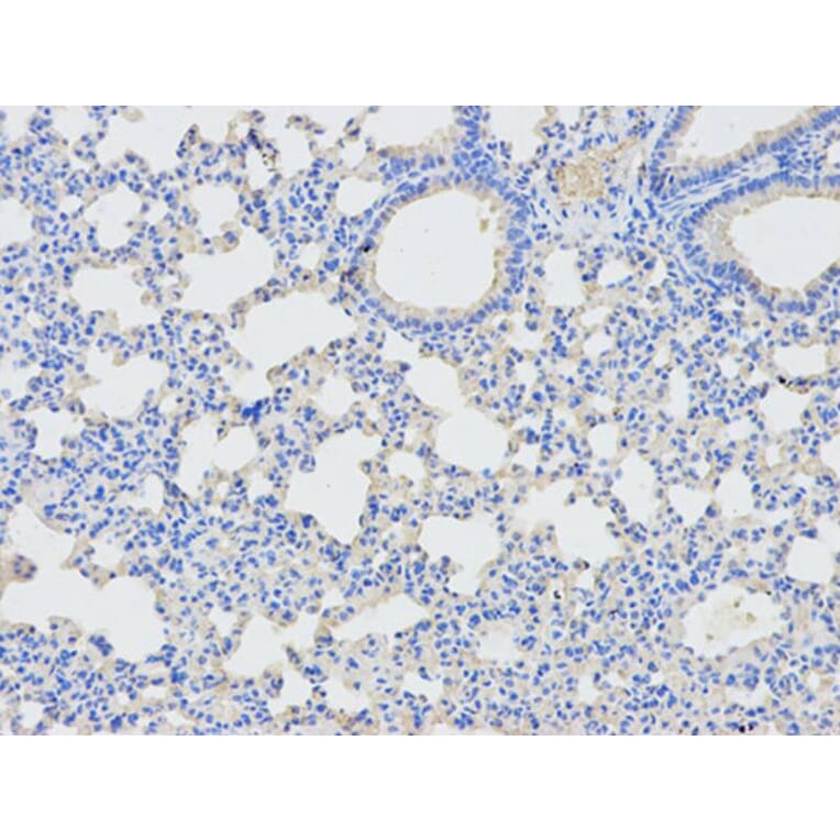 Immunohistochemistry - DPYD Antibody from Signalway Antibody (32346) - Antibodies.com